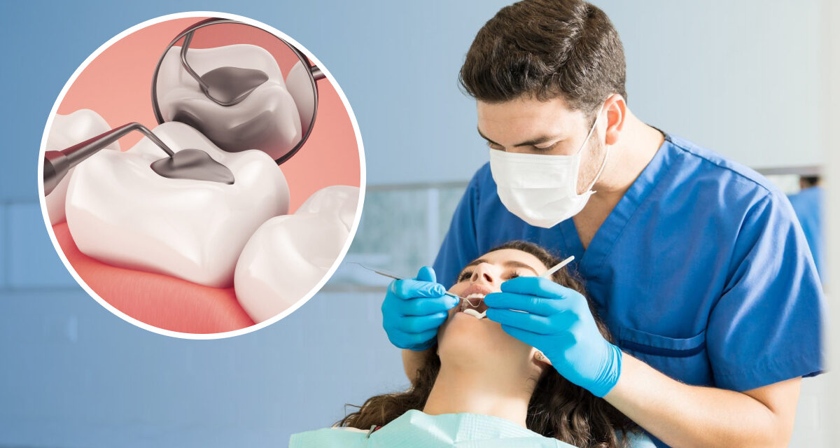 How long do dental fillings last?
