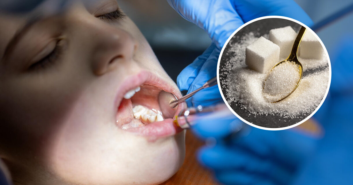 How Does Sugar Cause Cavities?
